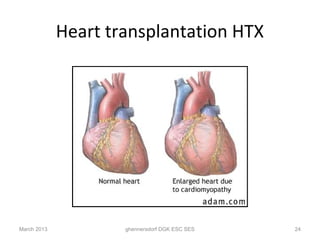 Heart transplantation HTX




March 2013           ghennersdorf DGK ESC SES   24
 