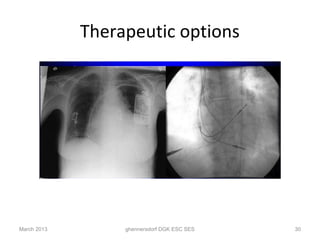 Therapeutic options




March 2013        ghennersdorf DGK ESC SES   30
 