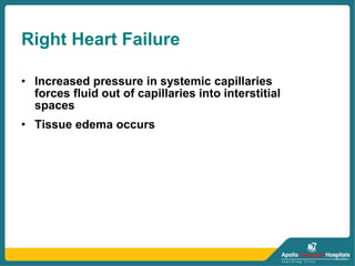 Right Heart Failure
• Increased pressure in systemic capillaries
forces fluid out of capillaries into interstitial
spaces
• Tissue edema occurs
 