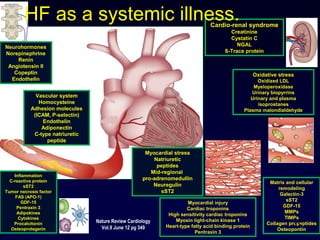Neurohormones
Norepinephrine
Renin
Angiotensin II
Copeptin
Endothelin
Vascular system
Homocysteine
Adhesion molecules
(ICAM, P-selectin)
Endothelin
Adiponectin
C-type natriuretic
peptide
Inflammation
C-reactive protein
sST2
Tumor necrosis factor
FAS (APO-1)
GDF-15
Pentraxin 3
Adipokines
Cytokines
Procalcitonin
Osteoprotegerin
Myocardial stress
Natriuretic
peptides
Mid-regional
pro-adrenomedullin
Neuregulin
sST2
Myocardial injury
Cardiac troponins
High sensitivity cardiac troponins
Myosin light-chain kinase 1
Heart-type fatty acid binding protein
Pentraxin 3
Matrix and cellular
remodeling
Galectin-3
sST2
GDF-15
MMPs
TIMPs
Collagen propeptides
Osteopontin
Cardio-renal syndrome
Creatinine
Cystatin C
NGAL
ß-Trace protein
Oxidative stress
Oxidized LDL
Myeloperoxidase
Urinary biopyrrins
Urinary and plasma
isoprostanes
Plasma malondialdehyde
HF as a systemic illness.
15
Nature Review Cardiology
Vol.9 June 12 pg 349
 