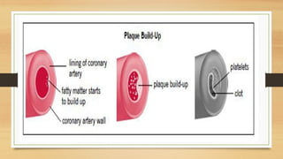 Heart Failure, Coronary Artery Disease and Heart.pptx