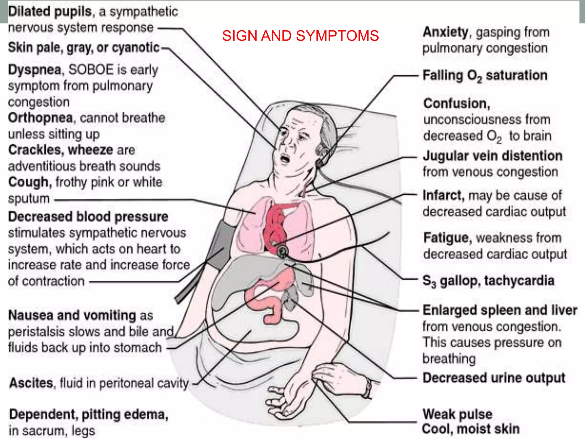 SIGN AND SYMPTOMS
 