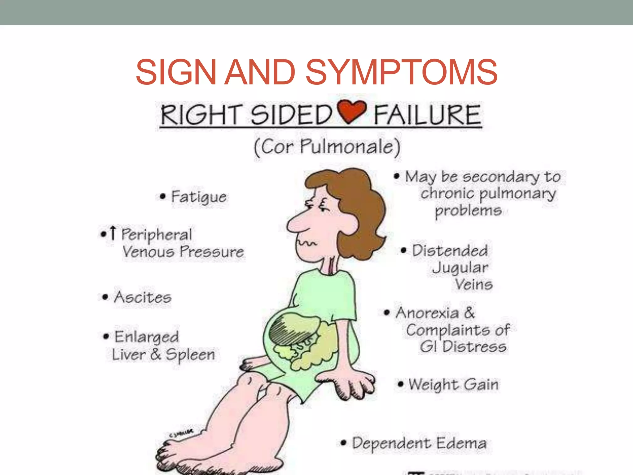 SIGN AND SYMPTOMS
 