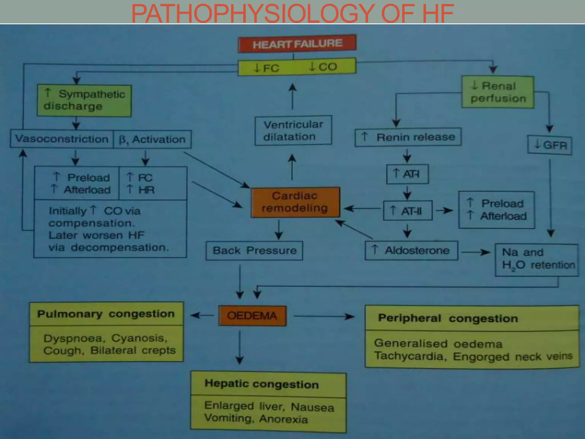 PATHOPHYSIOLOGY OF HF
 