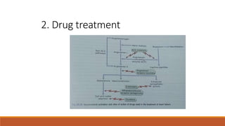 2. Drug treatment
 