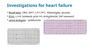 Comprehensive Overview of Heart Failure: Types, Pathophysiology, and ...