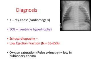 Diagnosis
• X – ray Chest (cardiomegaly)
• ECG – (ventricle hypertrophy)
• Echocardiography –
• Low Ejection Fraction (N = 55-65%)
• Oxygen saturation (Pulse oximetry) – low in
pulmonary edema
 