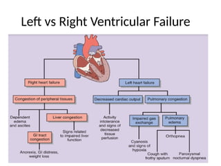 Left vs Right Ventricular Failure
• Left ventricular failure: pulmonary congestion, dyspnea.
• Right ventricular failure: systemic venous congestion,
peripheral edema.
 