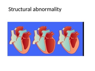 Structural abnormality
 