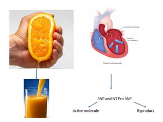 BNP and NT Pro BNP
Active molecule Byproduct
 