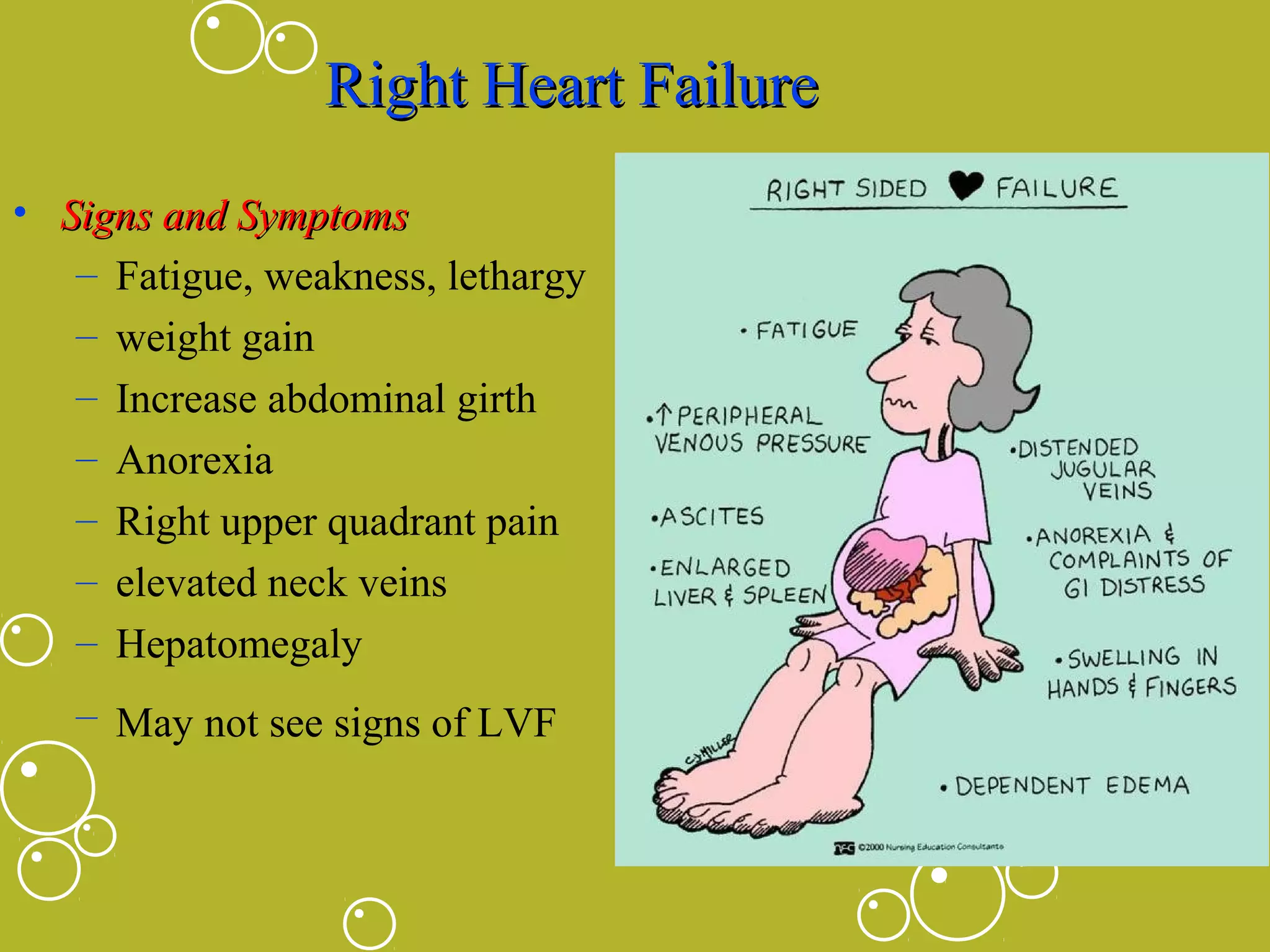 Right Heart Failure
• Signs and Symptoms
– Fatigue, weakness, lethargy
– weight gain
– Increase abdominal girth
– Anorexia
– Right upper quadrant pain
– elevated neck veins
– Hepatomegaly
– May not see signs of LVF

 