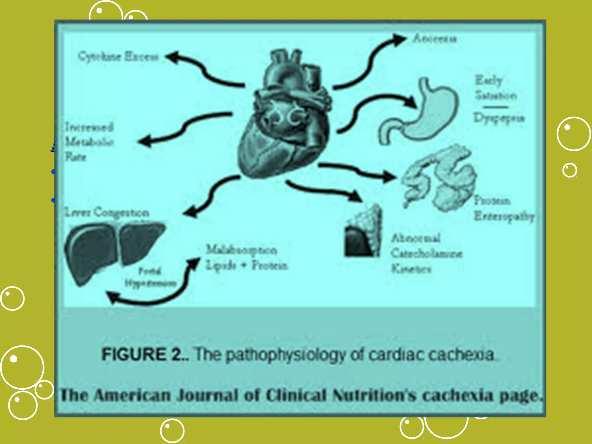 Heart Failure
Stage B
Nonpharmacological Interventions
• Salt :1.5gm for stage A&B and <3gm for stage C&D
• BMI: 30-34.9kg/m2 (grade 1 obesity) lowest mortality –
weight U-shaped mortality curve (cardiac cachexia)
cachexia
– daily weight monitoring – same time with same clothing
– Weight gain of 3 lb (1.5 kg) over 2 days or a 3- to 5-lb (2.5 kg)
gain over a week – report to health care provider

 
