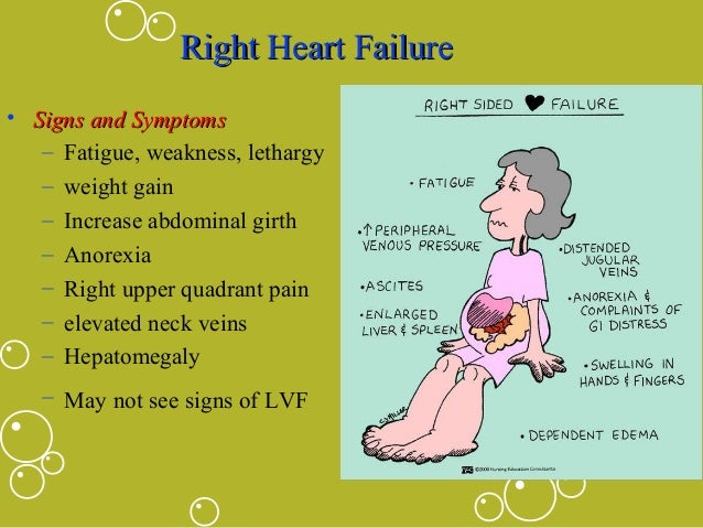 Image result for heart failure signs