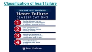 Classification of heart failure
 