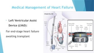 • Left Ventricular Assist
Device (LVAD):
For end-stage heart failure
awaiting transplant
Medical Management of Heart Failure
 