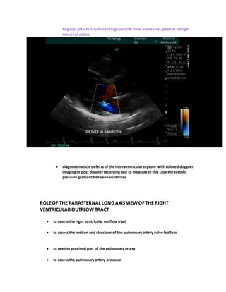 Regurgitantjetsorturbulenthighvelocityflowsare seenasgreenor a bright
mosaicof colors
 diagnose muscle defectsof the interventricularseptum withcolored doppler
imagingor post dopplerrecordingand to measure in this case the systolic
pressure gradient betweenventricles
ROLEOF THE PARASTERNAL LONG AXIS VIEWOF THE RIGHT
VENTRICULAR OUTFLOWTRACT
 to assess the right ventricular outflowtract
 to assess the motion and structure of the pulmonary artery valve leaflets
 to see the proximal part of the pulmonaryartery
 to assess the pulmonary artery pressure
 
