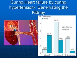 Curing Heart failure by curing
hypertension- Denervating the
Kidney
 
