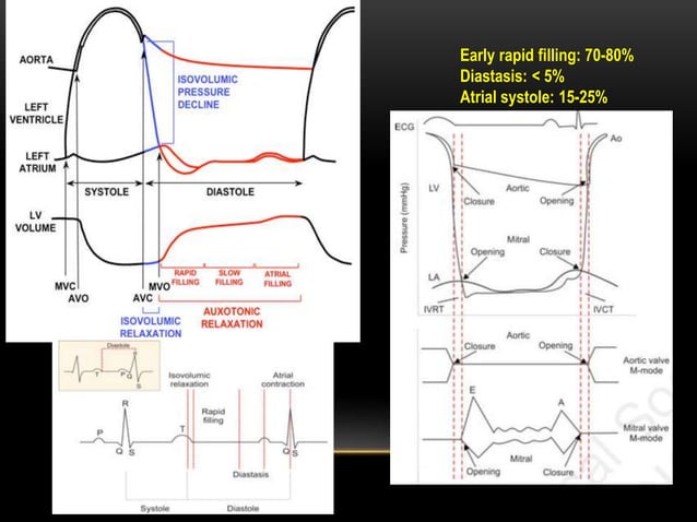 Heart failure with preserved ejection fraction | PPTX