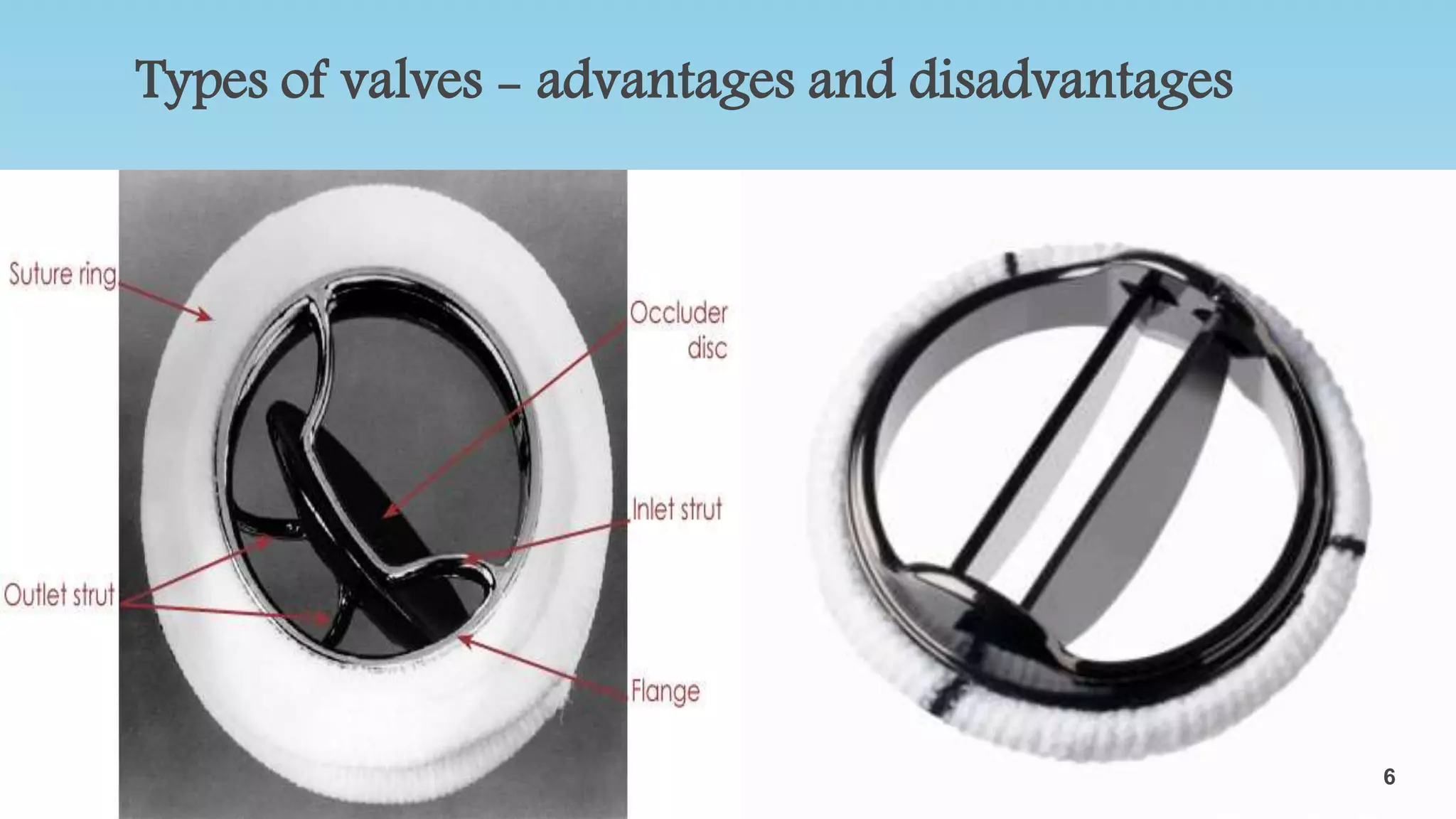 Types of valves - advantages and disadvantages
•Mechanical- There are three types. The caged ball, tilting disk, and
bileaflet. Lasts for over 20 years
•Tissue(biological)- valves that are used from animals to implant them
back into humans. Typically lasts between 10-15 years
6
6
 
