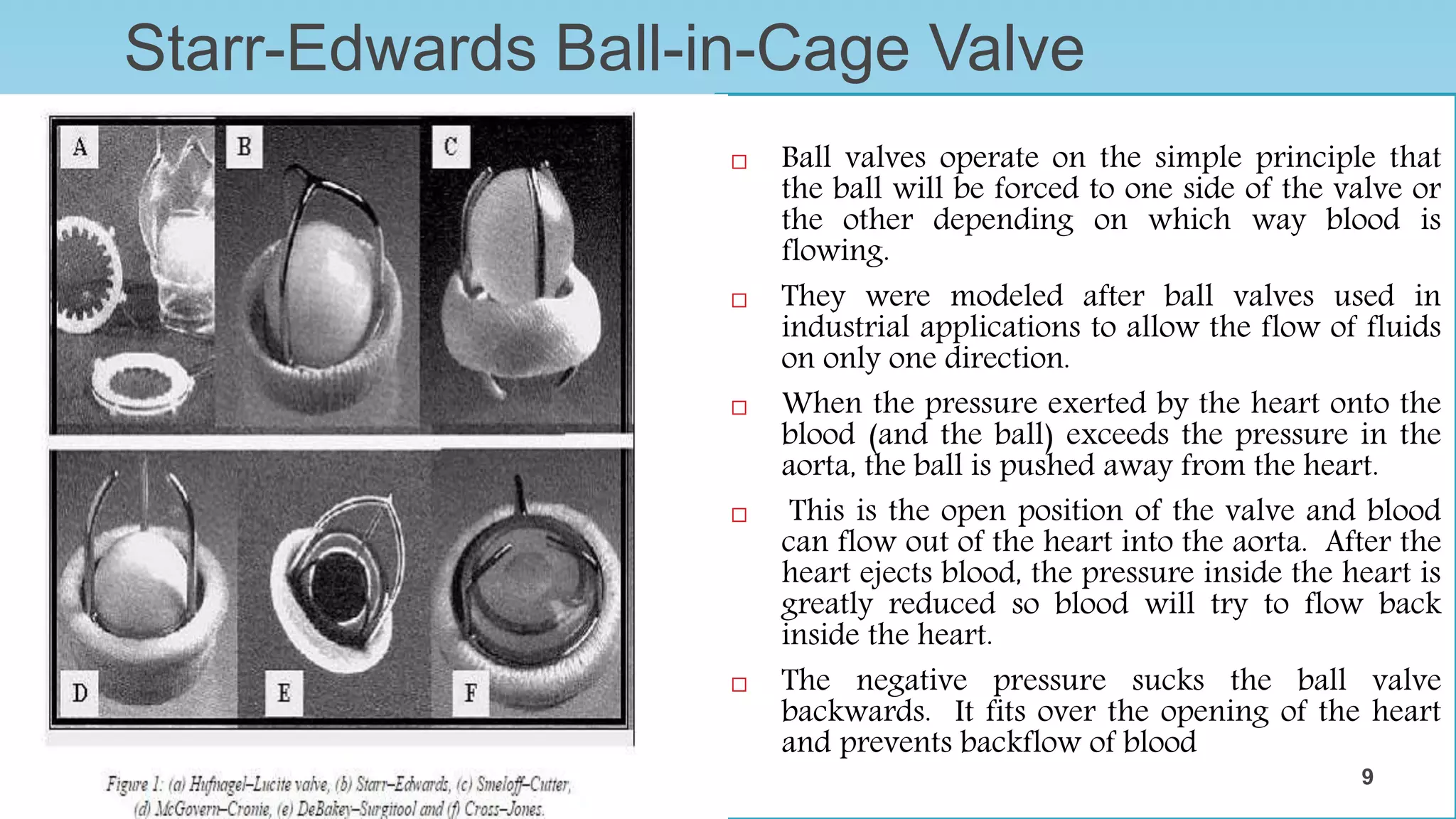 Starr-Edwards Ball-in-Cage Valve
The ball valve was the first mechanical heart
valve used and designed by Charles Hufnagel.
The Starr-Edwards ball valve was first used
clinically as a mitral valve replacement in
1960.
After the Starr-Edwards valve was established,
several other design variations were created
such as Magovern–Cromie, DeBakey–
Surgitool, and Smeloff–Cutter ball valves.
 Ball valves operate on the simple principle that
the ball will be forced to one side of the valve or
the other depending on which way blood is
flowing.
 They were modeled after ball valves used in
industrial applications to allow the flow of fluids
on only one direction.
 When the pressure exerted by the heart onto the
blood (and the ball) exceeds the pressure in the
aorta, the ball is pushed away from the heart.
 This is the open position of the valve and blood
can flow out of the heart into the aorta. After the
heart ejects blood, the pressure inside the heart is
greatly reduced so blood will try to flow back
inside the heart.
 The negative pressure sucks the ball valve
backwards. It fits over the opening of the heart
and prevents backflow of blood
9
9
 