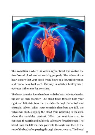15
This condition is where the valves in your heart that control the
free flow of blood are not working properly. The valves of the
heart ensure that your blood freely flows in a forward direction
and cannot leak backward. The way in which a healthy heart
operates is the same for everyone.
The heart contains four chambers with the heart valves placed at
the exit of each chamber. The blood flows through both your
right and left atria into the ventricles through the mitral and
tricuspid valves. When your ventricle chambers are full, the
valves will shut, stopping the blood from returning to the atria
when the ventricles contract. When the ventricles start to
contract, the aortic and pulmonic valves are forced to open. The
blood from the left ventricle goes into the aorta and then to the
rest of the body after passing through the aortic valve. The blood
 