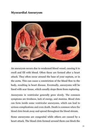 24
Myocardial Aneurysm
An aneurysm occurs due to weakened blood vessel, causing it to
swell and fill with blood. Often these are formed after a heart
attack. They often occur around the base of your septum, or in
the aorta. This can cause a constriction of the blood flow to the
body, resulting in heart disease. Eventually, aneurysms will be
lined with scar tissue, which usually stops them from rupturing.
Aneurysms in ventricular generally grow slowly. The common
symptoms are tiredness, lack of energy, and stamina. Blood clots
can form inside some ventricular aneurysms, which can lead to
serious complications and even death. Death is common when the
blood clots break away and spread throughout the blood stream.
Some aneurysms are congenital while others are caused by a
heart attack. The blood clots formed around them can block the
 