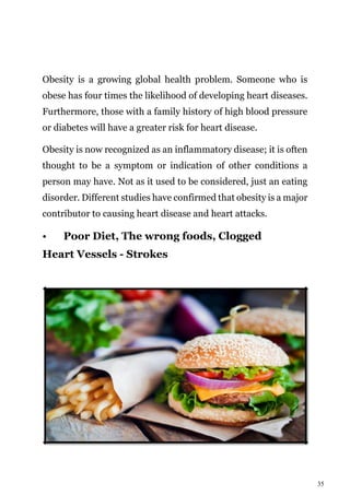 35
Obesity is a growing global health problem. Someone who is
obese has four times the likelihood of developing heart diseases.
Furthermore, those with a family history of high blood pressure
or diabetes will have a greater risk for heart disease.
Obesity is now recognized as an inflammatory disease; it is often
thought to be a symptom or indication of other conditions a
person may have. Not as it used to be considered, just an eating
disorder. Different studies have confirmed that obesity is a major
contributor to causing heart disease and heart attacks.
• Poor Diet, The wrong foods, Clogged
Heart Vessels - Strokes
 