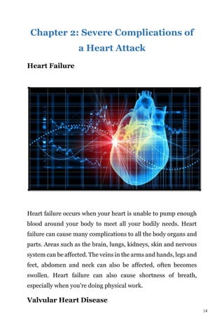 14
Chapter 2: Severe Complications of
a Heart Attack
Heart Failure
Heart failure occurs when your heart is unable to pump enough
blood around your body to meet all your bodily needs. Heart
failure can cause many complications to all the body organs and
parts. Areas such as the brain, lungs, kidneys, skin and nervous
system can be affected. The veins in the arms and hands, legs and
feet, abdomen and neck can also be affected, often becomes
swollen. Heart failure can also cause shortness of breath,
especially when you’re doing physical work.
Valvular Heart Disease
 