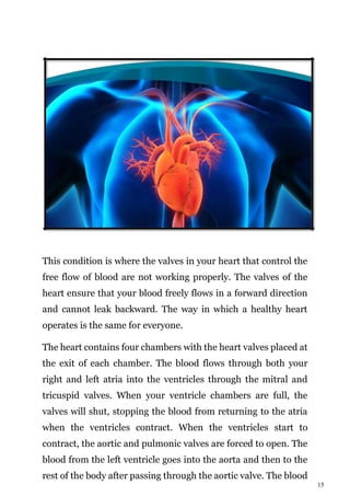15
This condition is where the valves in your heart that control the
free flow of blood are not working properly. The valves of the
heart ensure that your blood freely flows in a forward direction
and cannot leak backward. The way in which a healthy heart
operates is the same for everyone.
The heart contains four chambers with the heart valves placed at
the exit of each chamber. The blood flows through both your
right and left atria into the ventricles through the mitral and
tricuspid valves. When your ventricle chambers are full, the
valves will shut, stopping the blood from returning to the atria
when the ventricles contract. When the ventricles start to
contract, the aortic and pulmonic valves are forced to open. The
blood from the left ventricle goes into the aorta and then to the
rest of the body after passing through the aortic valve. The blood
 