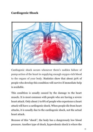 18
Cardiogenic Shock
Cardiogenic shock occurs whenever there’s sudden failure of
pump action of the heart in supplying enough oxygen-rich blood
to the organs of your body. Statistics show that about 50% of
people who develop this condition will survive if immediate help
is available.
This condition is usually caused by the damage to the heart
muscle. It is most common with people who are having a severe
heart attack. Only about 7 to 8% of people who experience a heart
attack will have a cardiogenic shock. When people die from heart
attacks, it is usually due to the cardiogenic shock, not the actual
heart attack.
Because of this “shock”, the body has a dangerously low blood
pressure. Another type of shock, hypovolemic shock is where the
 