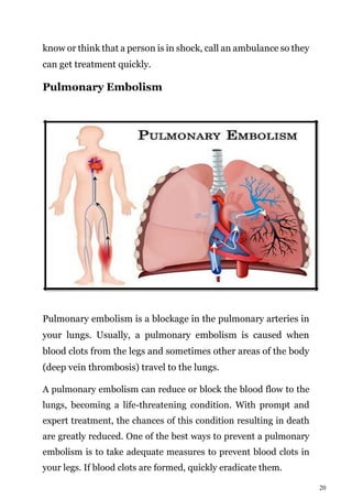 20
know or think that a person is in shock, call an ambulance so they
can get treatment quickly.
Pulmonary Embolism
Pulmonary embolism is a blockage in the pulmonary arteries in
your lungs. Usually, a pulmonary embolism is caused when
blood clots from the legs and sometimes other areas of the body
(deep vein thrombosis) travel to the lungs.
A pulmonary embolism can reduce or block the blood flow to the
lungs, becoming a life-threatening condition. With prompt and
expert treatment, the chances of this condition resulting in death
are greatly reduced. One of the best ways to prevent a pulmonary
embolism is to take adequate measures to prevent blood clots in
your legs. If blood clots are formed, quickly eradicate them.
 