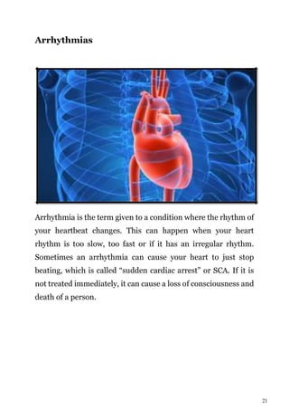 21
Arrhythmias
Arrhythmia is the term given to a condition where the rhythm of
your heartbeat changes. This can happen when your heart
rhythm is too slow, too fast or if it has an irregular rhythm.
Sometimes an arrhythmia can cause your heart to just stop
beating, which is called “sudden cardiac arrest” or SCA. If it is
not treated immediately, it can cause a loss of consciousness and
death of a person.
 