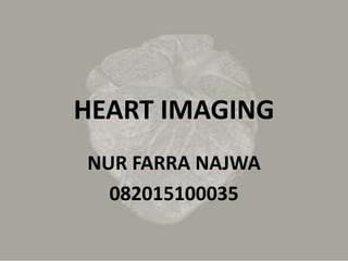 HEART IMAGING
NUR FARRA NAJWA
082015100035
 