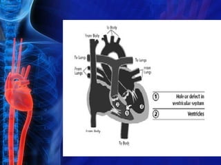 Heart lecture 1