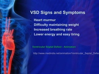 VSD Signs and Symptoms
•    Heart murmur
•    Difficulty maintaining weight
•    Increased breathing rate
•    Lower energy and easy tiring


    Ventricular Septal Defect - Animation

    http://www.medindia.net/animation/Ventricular_Septal_Defec
 