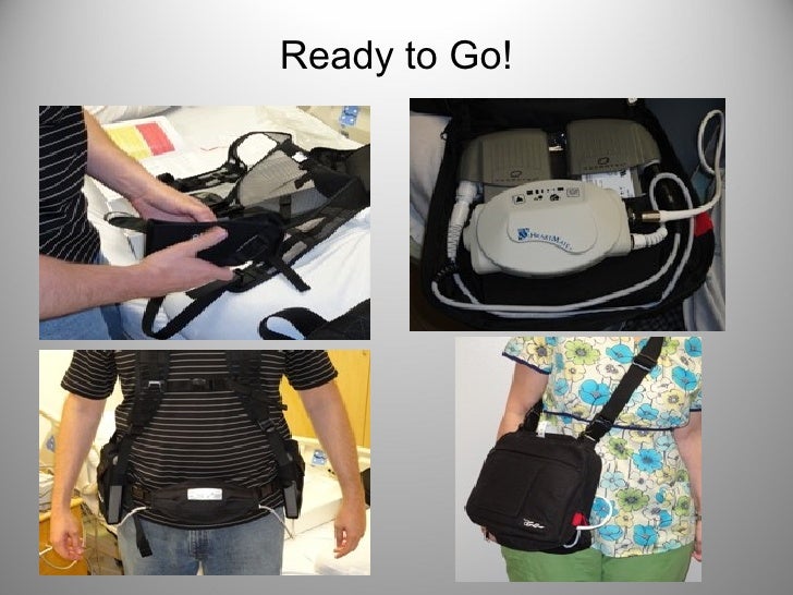 Heart mate ii lvad basic user updated per moses cone