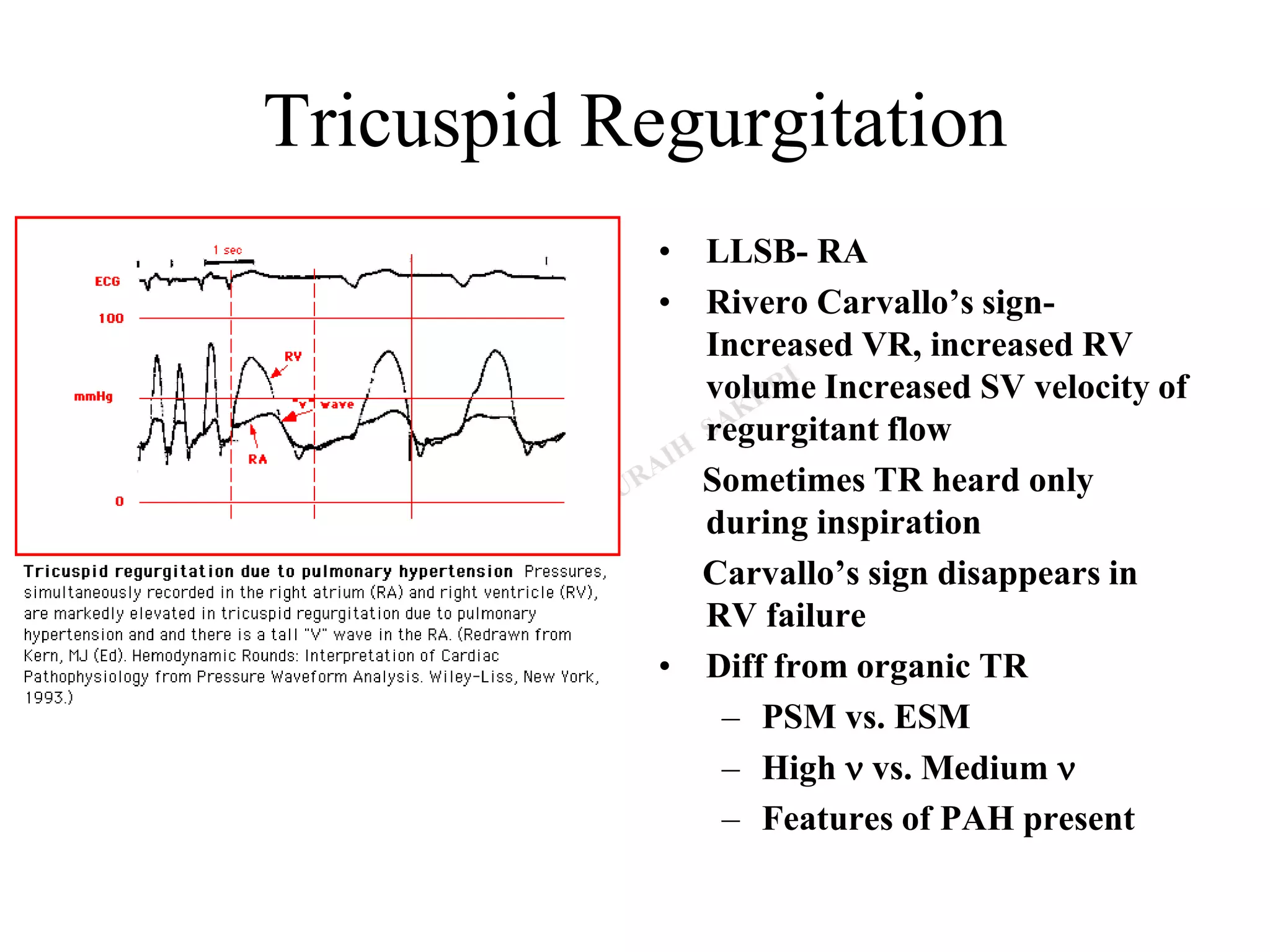 Tricuspid Regurgitation
• LLSB- RA
• Rivero Carvallo’s sign-
Increased VR, increased RV
volume Increased SV velocity of
regurgitant flow
Sometimes TR heard only
during inspiration
Carvallo’s sign disappears in
RV failure
• Diff from organic TR
– PSM vs. ESM
– High n vs. Medium n
– Features of PAH present
 