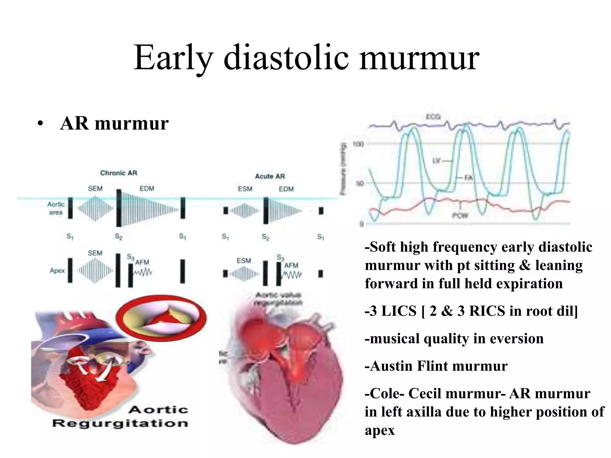 Early diastolic murmur
• AR murmur
-Soft high frequency early diastolic
murmur with pt sitting & leaning
forward in full held expiration
-3 LICS [ 2 & 3 RICS in root dil]
-musical quality in eversion
-Austin Flint murmur
-Cole- Cecil murmur- AR murmur
in left axilla due to higher position of
apex
 