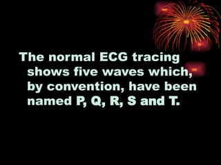 The normal ECG tracing
shows five waves which,
by convention, have been
named P, Q, R, S and T.
 