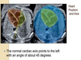 Heart n thorax | PPTX