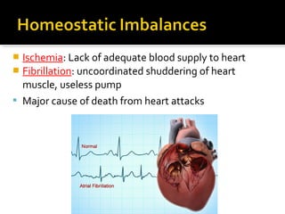  Ischemia: Lack of adequate blood supply to heart
 Fibrillation: uncoordinated shuddering of heart
muscle, useless pump
 Major cause of death from heart attacks
 