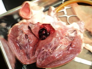 Heart Dissection Pictures: Block B and G