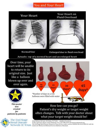 How low can you go?
Patient’s dry weight or target weight
often changes. Talk with your doctor about
what your target weight should be!
Over time, your
heart will be unable
to return to its
original size. Just
like a balloon
blown up over and
over again.
This poster
was
created
for
patients by patients
4040 McEwen Rd Suite 350 Dallas, TX 75244 ~ info@nw14.esrd.net
To file a grievance please contact Network 14 at 1-877-886-4435 and www.esrdnetwork.org
The End Stage Renal Disease Network of Texas (#14) is under contract #HHSM-500-2010-NW014C with the
Centers for Medicare & Medicaid Services Baltimore, Maryland.
You and Your Heart
No
Fill*
15
Days*
30
Days*
45
Days*
*Number of days in a row
balloons were filled with water
 