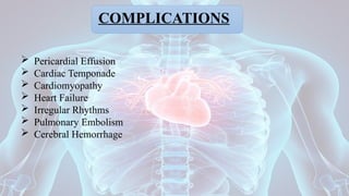 COMPLICATIONS
 Pericardial Effusion
 Cardiac Temponade
 Cardiomyopathy
 Heart Failure
 Irregular Rhythms
 Pulmonary Embolism
 Cerebral Hemorrhage
 