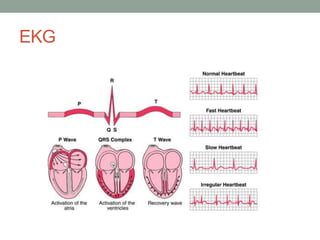 EKG
 