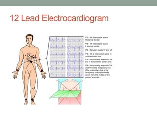 12 Lead Electrocardiogram
 