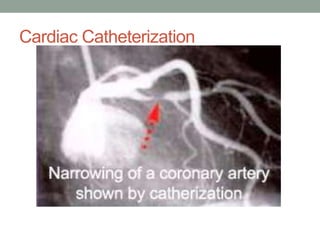 Cardiac Catheterization
 