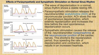 Effects of Parasympathetic and Sympathetic Stimulation on Normal Sinus Rhythm
• The wave of depolarization in a normal
sinus rhythm shows a stable resting HR.
• Parasympathetic stimulation releases the
neurotransmitter acetylcholine (ACh) at the
neuromuscular junction. ACh slows the rate
of spontaneous depolarization, which
extends repolarization and increases the
time before the next spontaneous
depolarization occurs.
• Sympathetic stimulation causes the release
of the neurotransmitter norepinephrine at
the neuromuscular junction of the cardiac
nerves. This shortens the repolarization
period, thus speeding the rate of
depolarization and contraction, which
results in an increased heartrate.
 