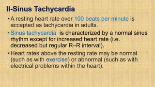 II-Sinus Tachycardia
•A resting heart rate over 100 beats per minute is
accepted as tachycardia in adults.
•Sinus tachycardia is characterized by a normal sinus
rhythm except for increased heart rate (i.e.
decreased but regular R–R interval).
•Heart rates above the resting rate may be normal
(such as with exercise) or abnormal (such as with
electrical problems within the heart).
 