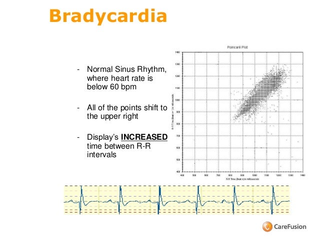 point carré heart rate point carré heart rate